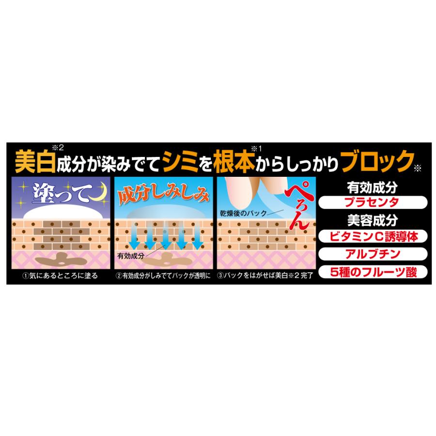 マイノロジ 薬用シミネールEX 美白パック 送料無料 爆買 : ポイント