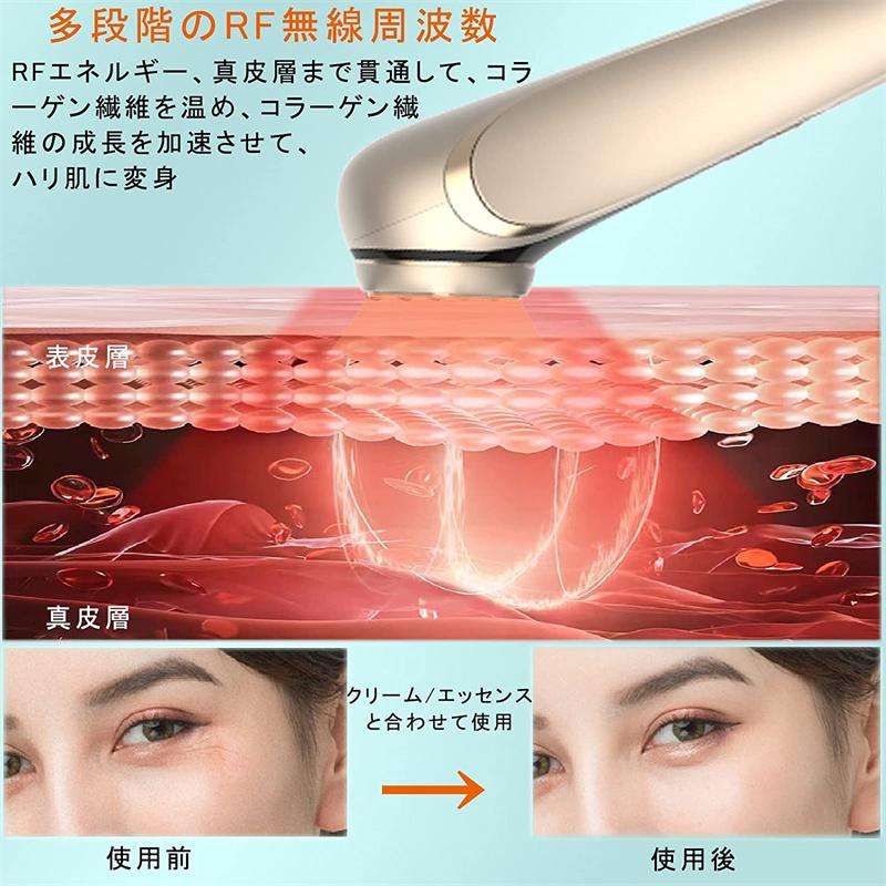 玄関先迄納品玄関先迄納品美顔器 RF美顔器 イオン導出 イオン導入 EMS