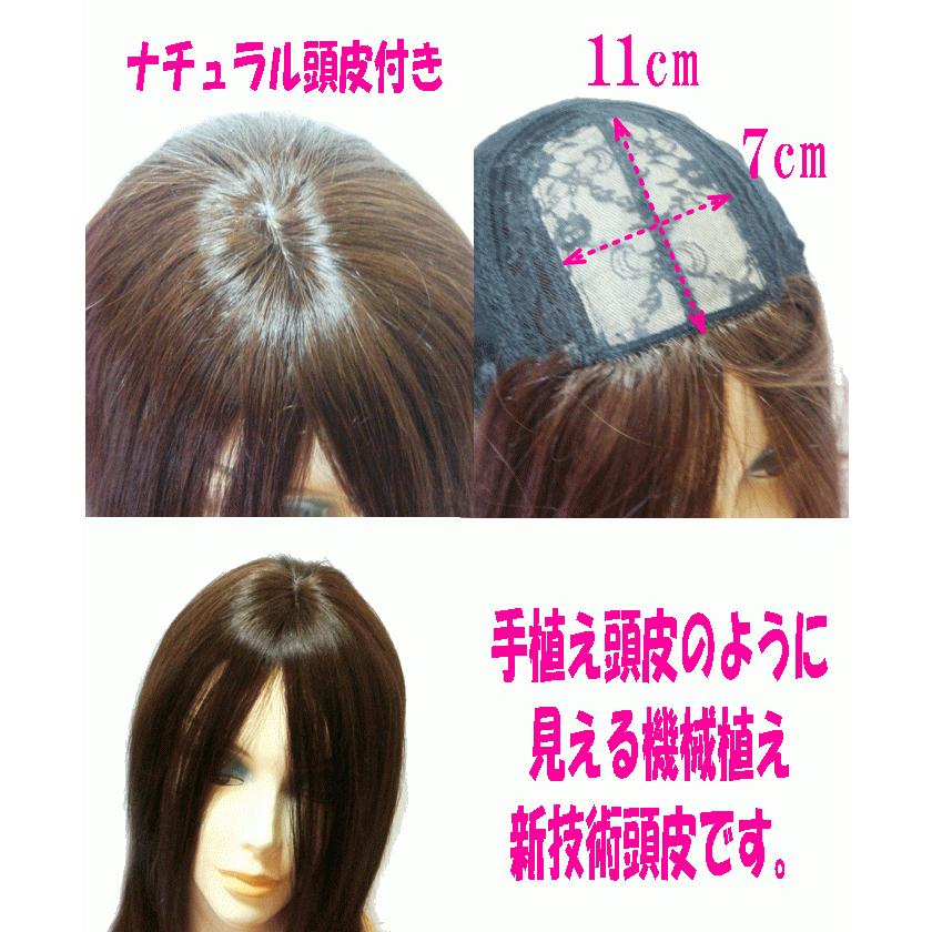 人毛フルウィッグ 医療用ウィッグ かつら ナチュラル頭皮 人毛100％ 最
