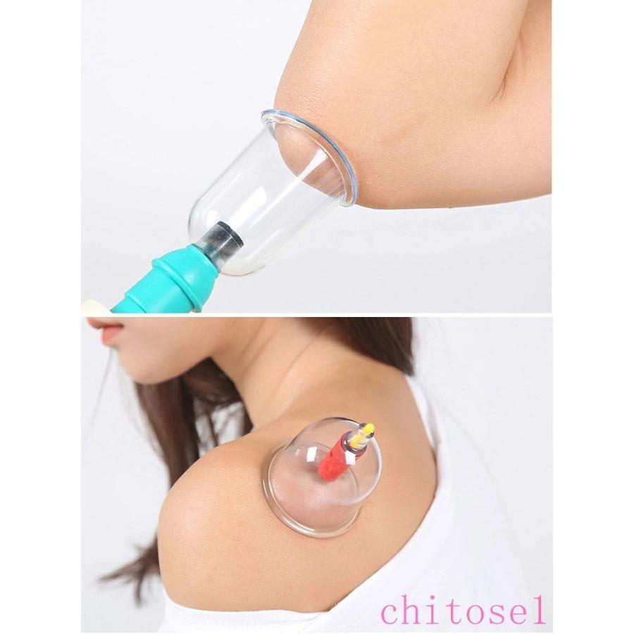 吸玉 カッピング 吸い玉 12個セット 吸引器 *吸玉 マッサージ カップ