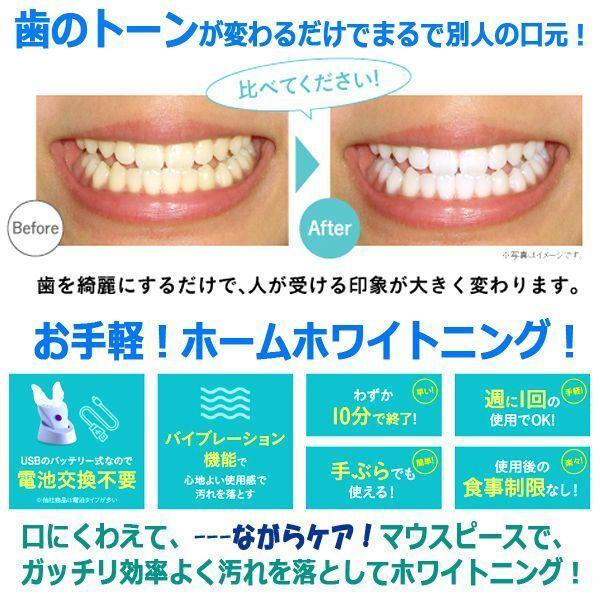 ホワイトニングマウスピース、ジェル マウスピース型ホワイトニング！スマイルブライター＋専用ジェル1本