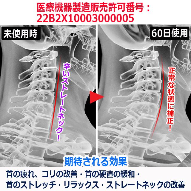 一般医療機器 Tech Loveダイヤル式ネックストレッチャーPRO 爆買 母の