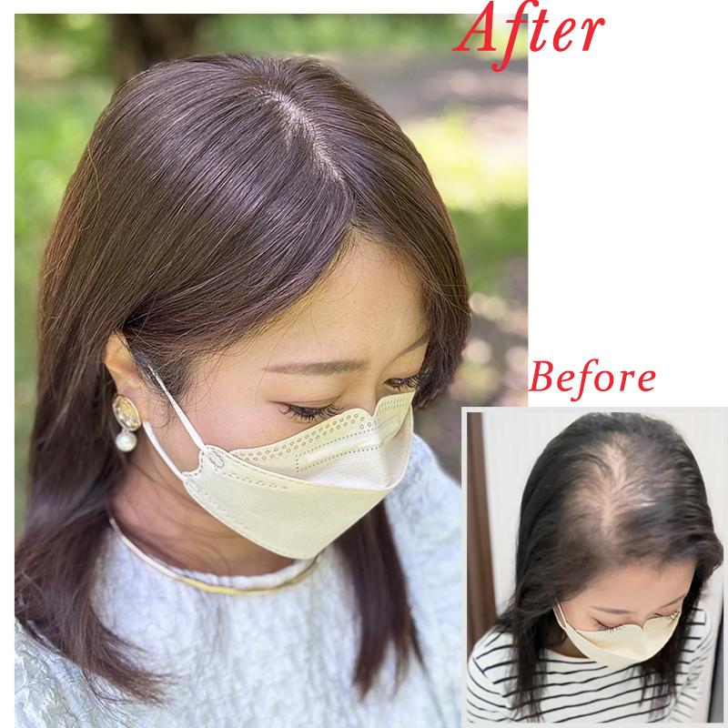 中面積 8×12cm トップピース 人毛 ヘアピース 白髪隠し 自然 通気性 分け目自由 高品質 総手植え 35cm 白髪かくし 薄毛対策 私元気BHADBS812 | 私元気 | 03