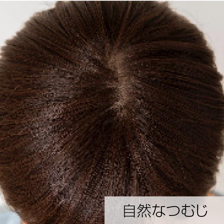 SVENSON（スヴェンソン） 医療用ウィッグ 女性 人工毛 医療用 ウィッグ