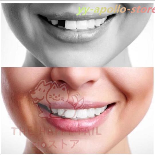 義歯 仮歯 テンポラリートゥースキット マルチシェイド 3色セット 抜け歯 欠け歯 つけ歯 差し歯 入れ歯 |  | 02