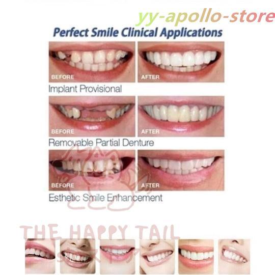 義歯 仮歯 テンポラリートゥースキット マルチシェイド 3色セット 抜け歯 欠け歯 つけ歯 差し歯 入れ歯 |  | 03