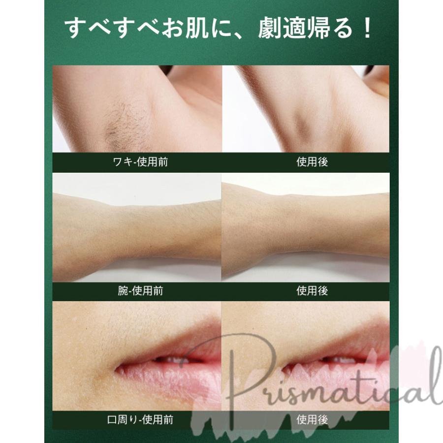脱毛器 女性 メンズ vio対応 IPL光脱器 99万回 5段階 美肌効果 脱毛器 女性 メンズ vio対応 IPL光脱器 99万回 5段階 美肌効果