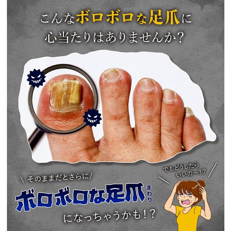 メール便対応 爪ケア 爪割れ トラブル 乾燥 薬用足爪ジェル フットケア
