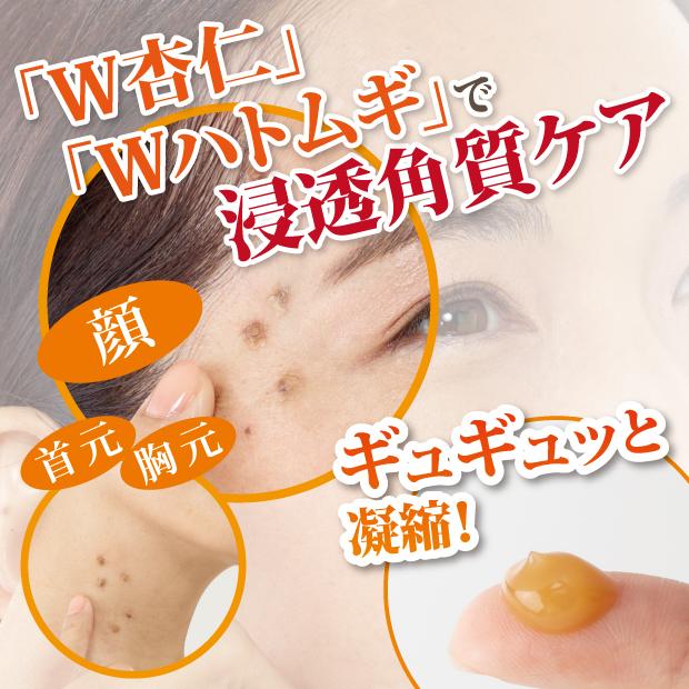 角質ケア オールインワン イボケア イポロンG 150g 増量版 イボ いぼ