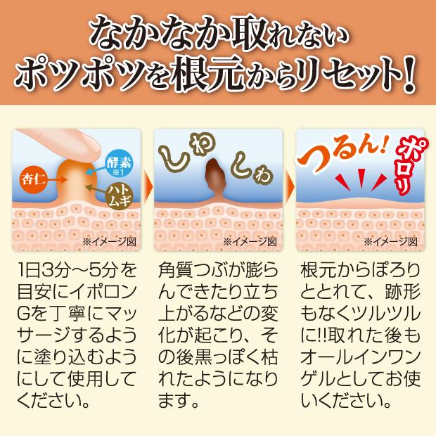 角質ケア オールインワン イボケア イポロンG 150g 増量版 イボ いぼ