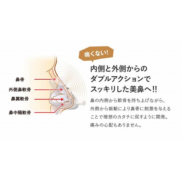 鼻 美鼻 矯正 ビューティーリフトハイノーズ エクストラ 軟骨 整形