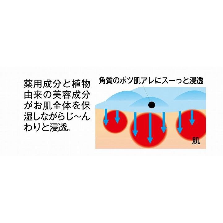 パック スキンケア 基礎化粧品 角質ケア 角質除去  薬用ツブ・ナイトKゲル 顔 首元 ぽつぽつ ポツポツ ぽつぽつ肌 角質 角質粒 甘草エキス ハトムギ｜profit｜07