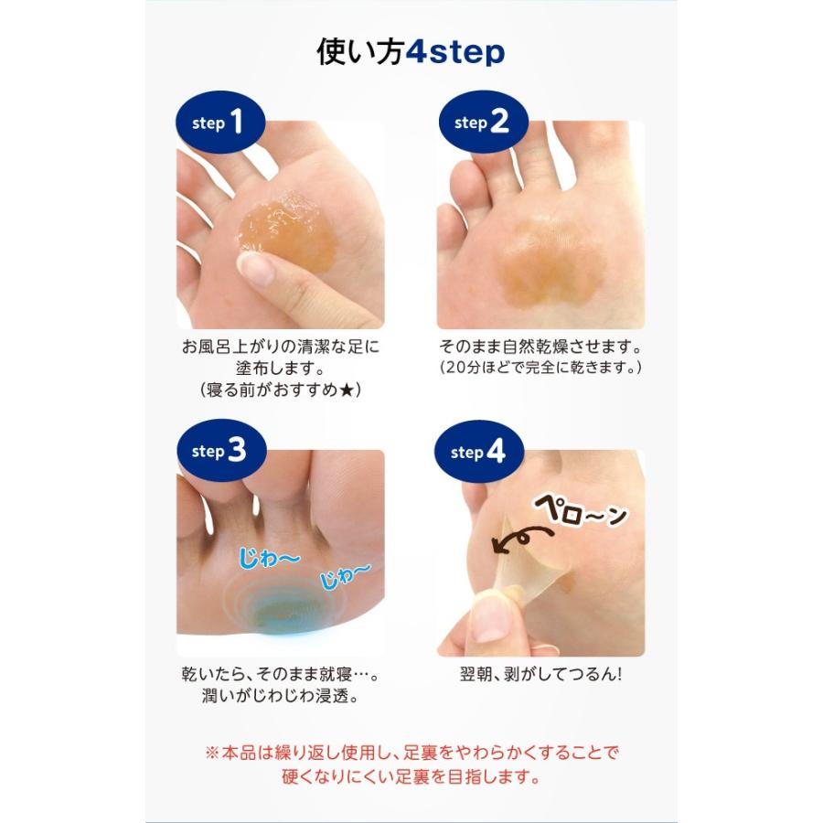 PROIDEA まめノン 足裏角質ケア 足裏 角質 角質除去 かかと