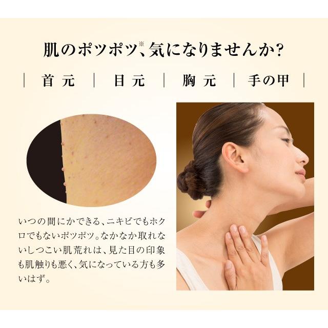 ぽっつるん ハーバルリッチ イボ 薬 除去 クリーム ヨクイニ ン イボ取り 角質粒 プロイデア 0070 3709 プロイデア Yahoo ショッピング店 通販 Yahoo ショッピング