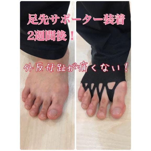 足先サポーター 藤田トレーナー監修 特許技術 外反母趾 O脚 浮き指 腰痛 膝関節痛 足裏アーチ 足底筋膜炎 重心バランス改善 男女兼用 １組 両足 Asisaki Projectid Yahoo 店 通販 Yahoo ショッピング