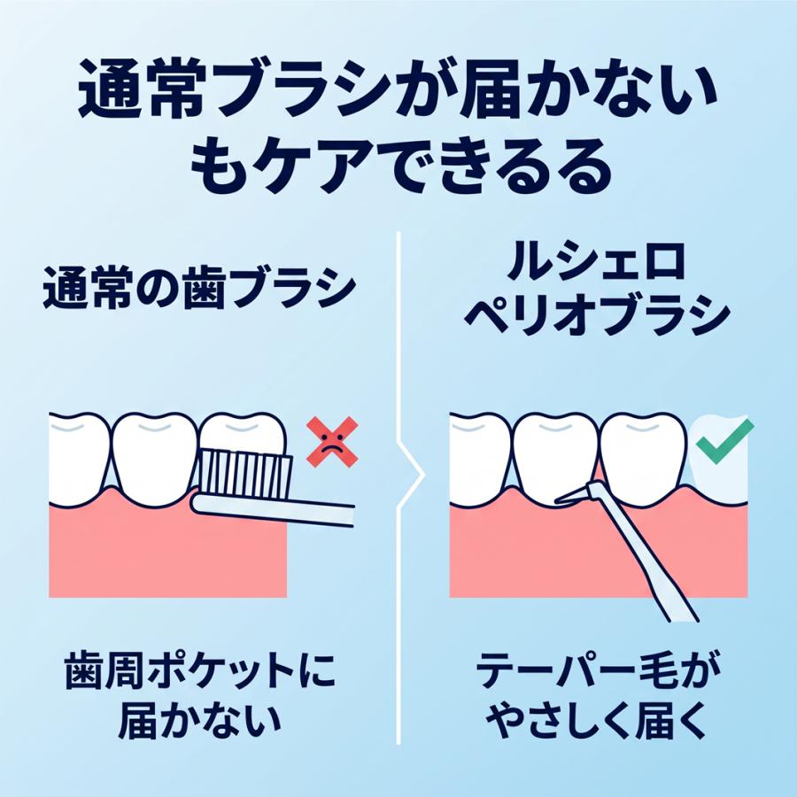 GC（ジーシー） ルシェロ ペリオブラシ 替ブラシ 医院用 10個入 歯科