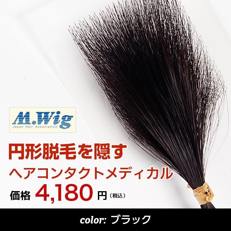 【中古品(10回使用)】プロピア　レディース　トップ用ウィッグ 円形脱毛症 隠す 医療用 部分 ウィッグ 自然 男性 女性 プロピア