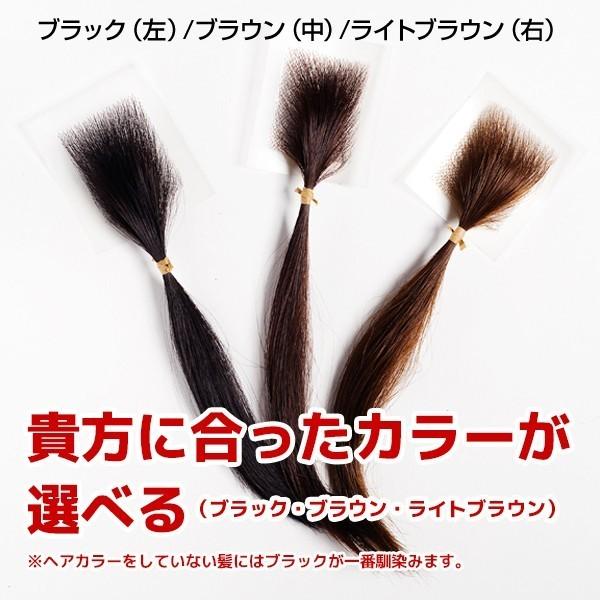 医療用かつら 円形脱毛症を隠す 部分ウィッグ ヘアコンタクト