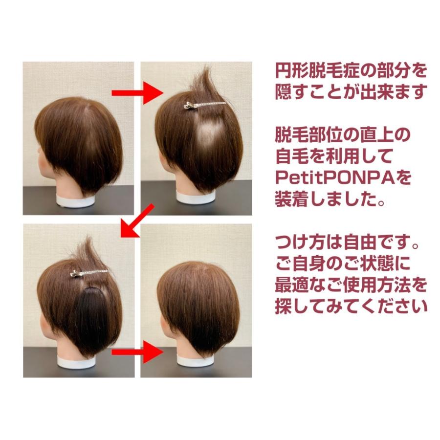 部分 ウィッグ 人毛 100% 自然 医療用 円形脱毛症 隠す ショート