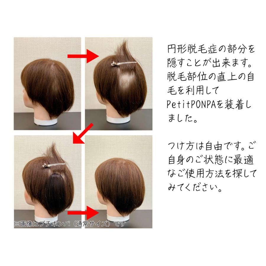 部分 ウィッグ 人毛 100% 自然 医療用 円形脱毛症 隠す 総手植え