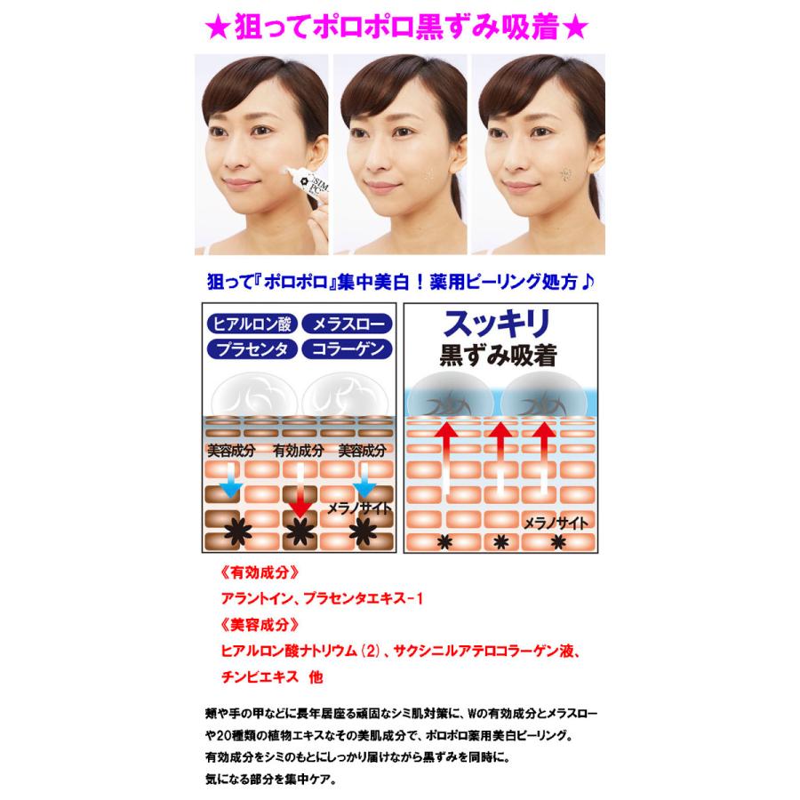 【スーパージェクション】美白シミ消し3点セット 薬用 シミーポロン メール便 送料無料 シミ しみ 角質 クリーム シミ