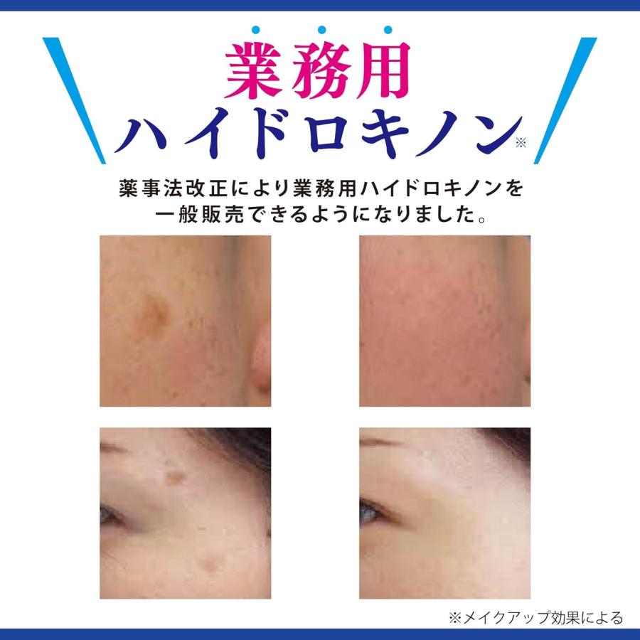 2本セット)業務用ハイドロキノンクリーム5％ 15g ハイドロキノン 旭