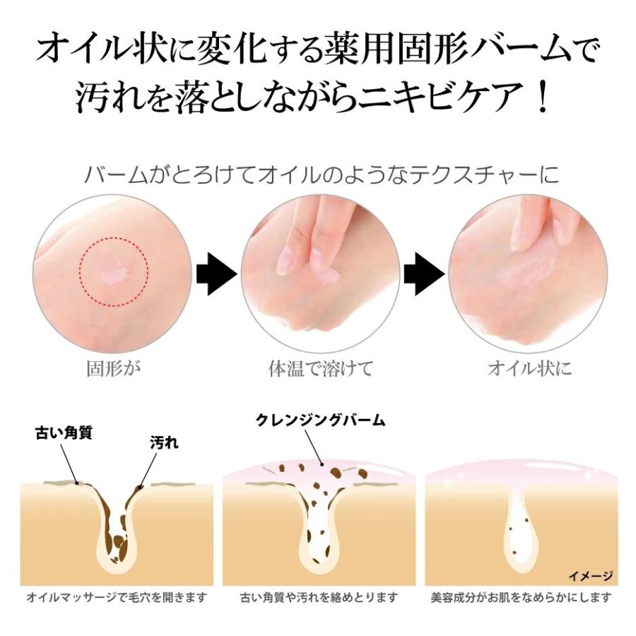 おしり ニキビ オイル 角質ケア くすみ ザラザラ 美尻ケア 薬用 固形バーム ニキビ予防 美容成分 クレンジング 魅惑のおしり クレンジングバーム｜pureseek｜04