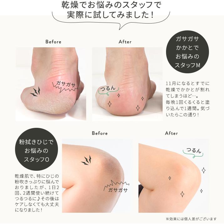 【本日26％OFF！】保湿 クリーム かかと ひじ ひざ  角質ケア【KOTONA エモリエントバーム】 |  | 02