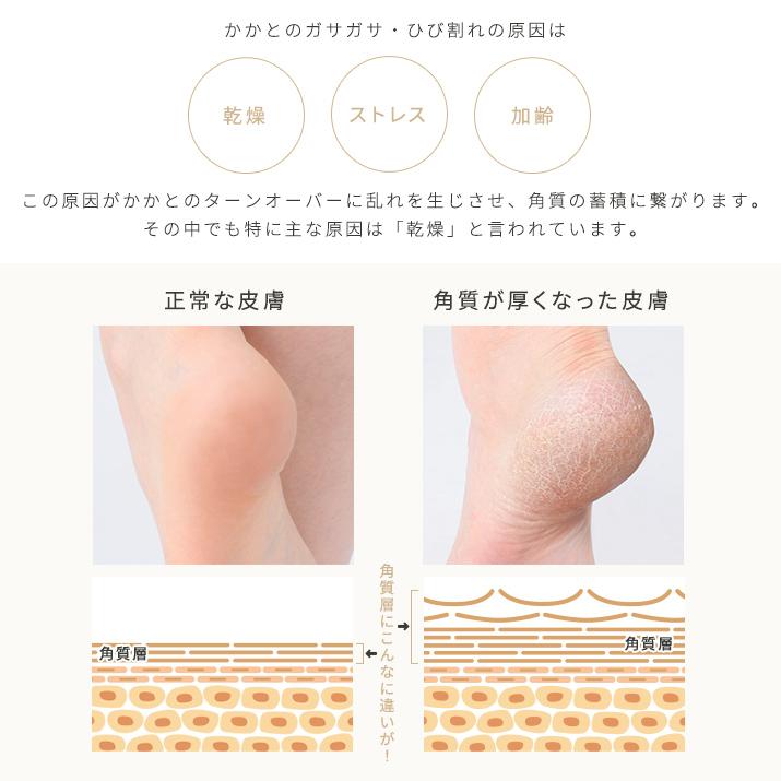 【本日26％OFF！】保湿 クリーム かかと ひじ ひざ  角質ケア【KOTONA エモリエントバーム】 |  | 08