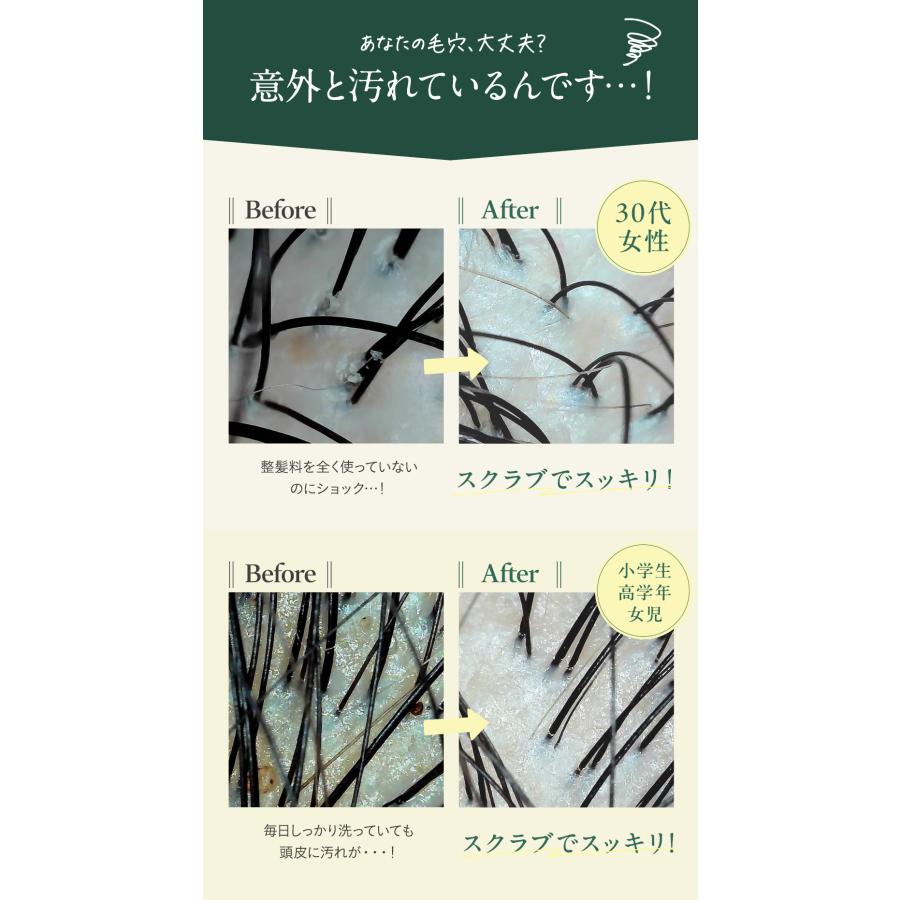 【本日30％OFF！】ヘッドスクラブ 頭皮ケア スカルプ 頭皮臭 ニオイ クレンジング 頭皮マッサージ ヘッドスパ【KOTONA・Refreshed Scalp Scrub】 |  | 02