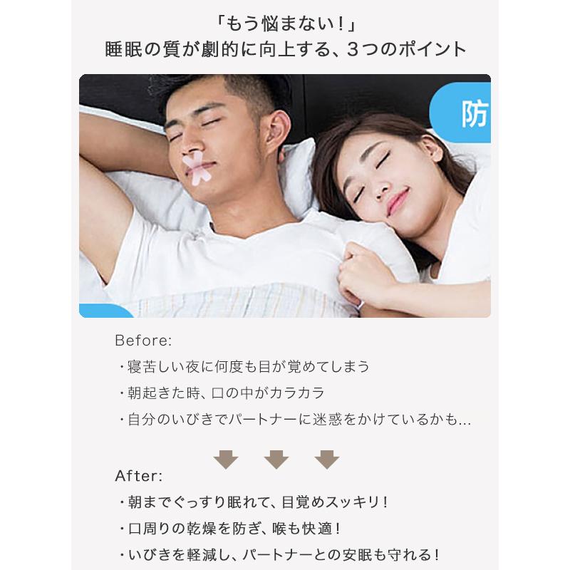 口閉じテープ 30枚入 マウステープ X型 鼻呼吸テープ 鼻呼吸 鼻呼吸