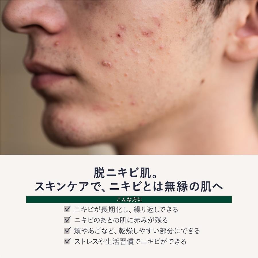ニキビ ケア メンズ 男性用 保湿ジェル クリーム 医薬部外品 50g ボタニカル アクネ ＆ ポア トリートメント クワトロボタニコ | QUATTRO BOTANICO | 01