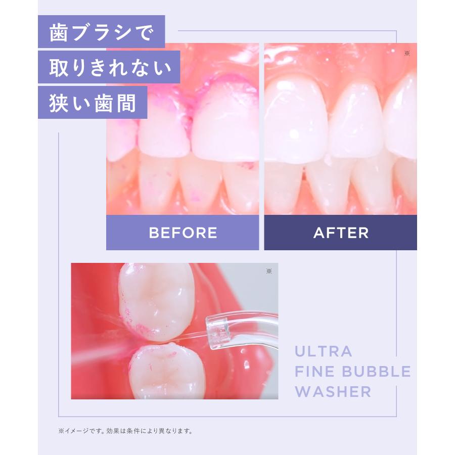 口腔洗浄器 BEAURAL ビューラル ウルトラファインバブルウォッシャー