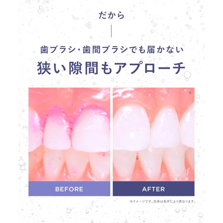 口腔洗浄器 BEAURAL ビューラル ウルトラファインバブルウォッシャー 本体 ノズル セット 虫歯予防 歯周ケア 口腔内洗浄器 歯垢除去の画像