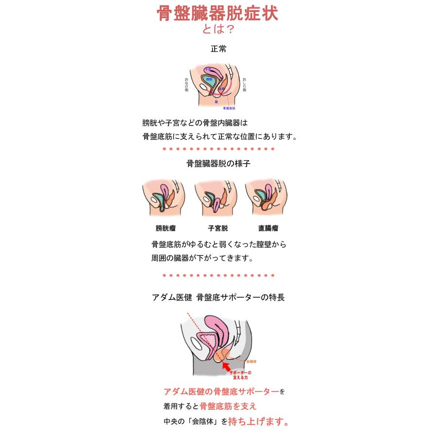 アダム医健 骨盤底サポーター 骨盤臓器脱 頻尿 排尿障害 骨盤底筋 一般