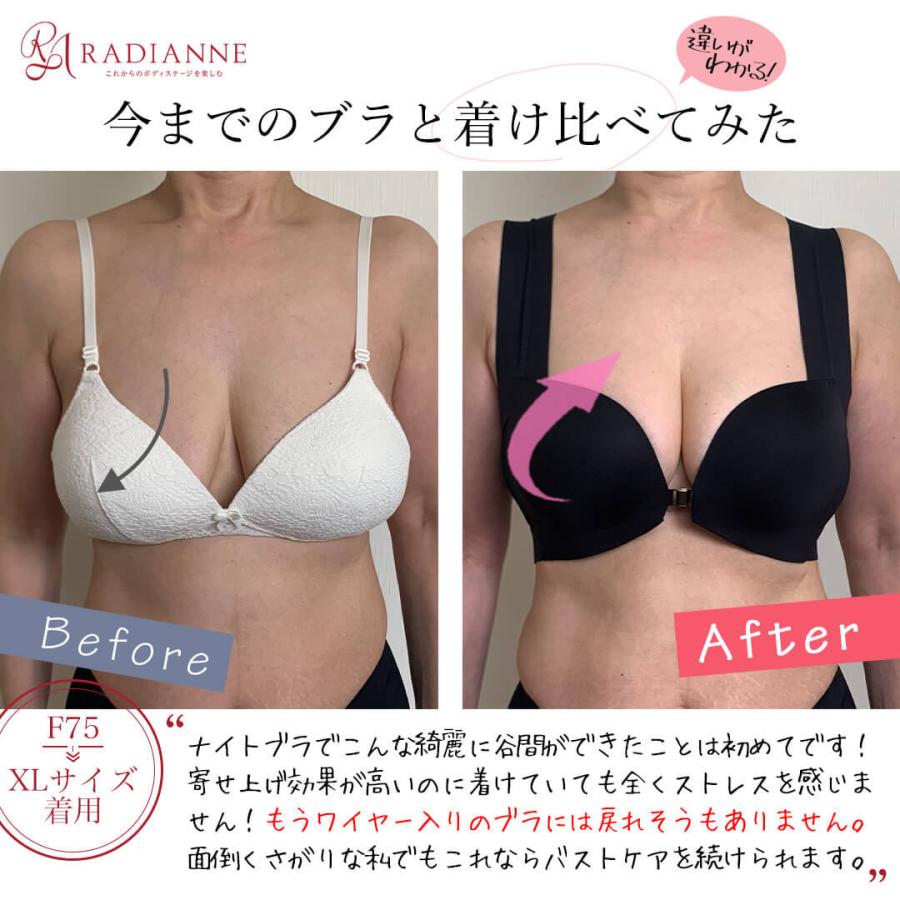 ナイトブラ 育乳ブラ 昼夜兼用 すっぴんナイトブラ フロントホック 2枚セット 小胸 ナイトブラ 大きいサイズ ノンワイヤー ラディアンヌ :bra00048-b3:ラディアンヌ Yahoo!店 - 通販 - Yahoo!ショッピング ナイトブラ 育乳ブラ 昼夜兼用 すっぴんナイトブラ フロントホック 2枚セット 小胸 ナイトブラ 大きいサイズ ノンワイヤー ラディアンヌ :bra00048-b3:ラディアンヌ Yahoo!店 - 通販 - Yahoo!ショッピング