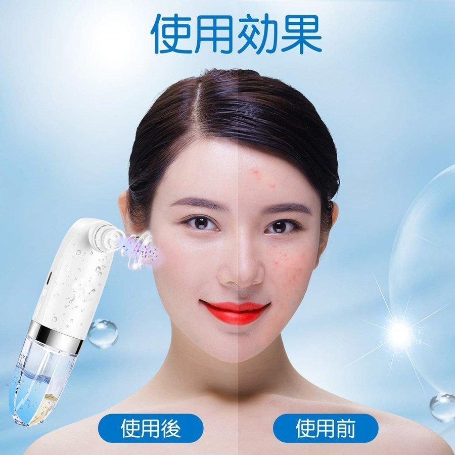 保湿毛穴吸引器 水槽分離水洗浄型吸引美顔器 吸引しながらクリーニング しわ減少 ヘッド6種 汚れ除去 角質 吸引レベル3段階 ニキビ吸引 スキンケア Mr D043 レインボーストア 通販 Yahoo ショッピング
