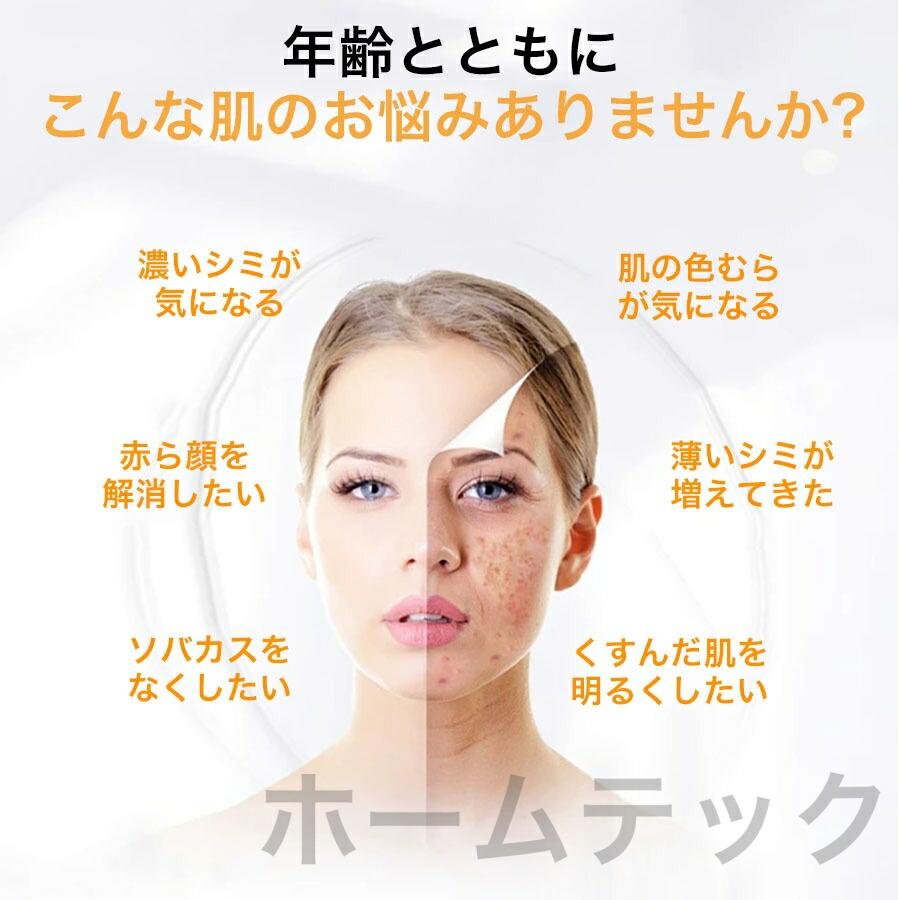 ピコレーザー 美顔器 美容機器 自宅 家庭用 レーザーペン シミ取り