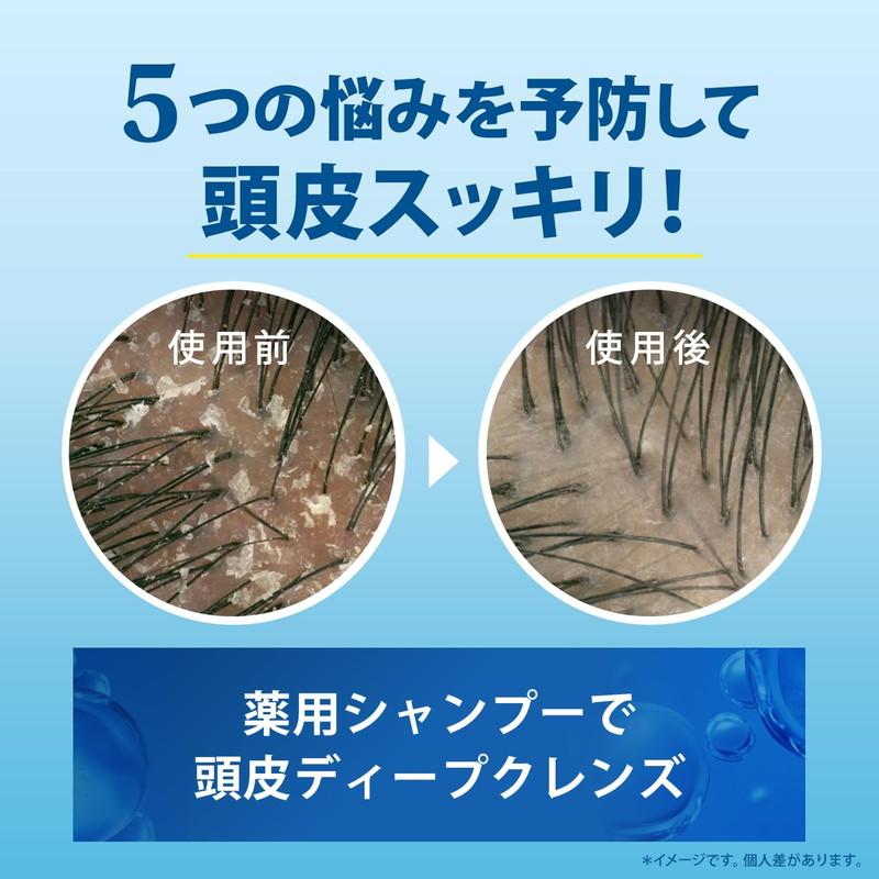 h&s P&G エイチアンドエス 5in1 クールクレンズ シャンプー 超特大詰替