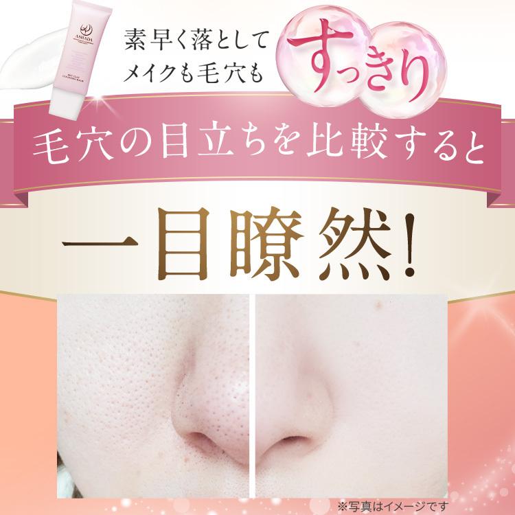 メイク落とし 洗顔 アスハダ ホット クレンジング バーム 2本セット 毛穴 黒ずみ 角栓 ASHADA | ASHADA | 01