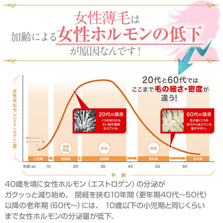 育毛剤 女性用 薬用 ヘアモア 詰め替え用エコパック お得12袋セット 抜け毛 予防 対策 Hairmore | Hairmore | 05