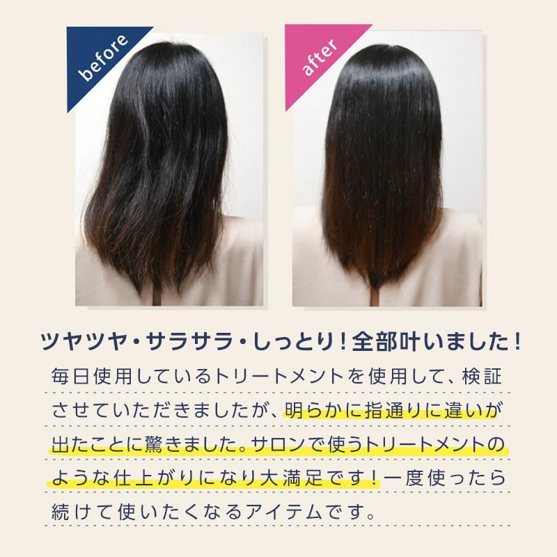 carerise トップフィールド ケアライズ プレミアム ウルトラソニック