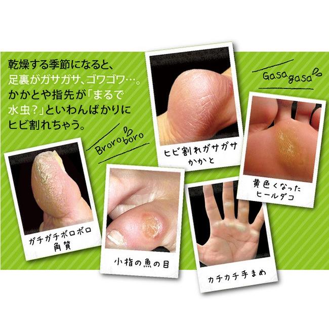 国内正規総代理店アイテム 訳あり 箱破損特価 スクラッチスマート 角質削り 角質除去 フットケア 足裏 ヤスリ 代引不可 かかと 角質ケア メール便 素数