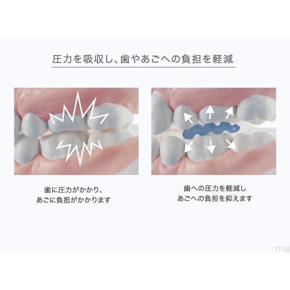 歯ぎしりピタリ ストロング マウスピース 歯圧吸収 歯型形成不要 衛生的 シリコン 高耐久性 日本製 食いしばり 頭痛 ?み合わせ 0070-2667｜rcmdse｜04