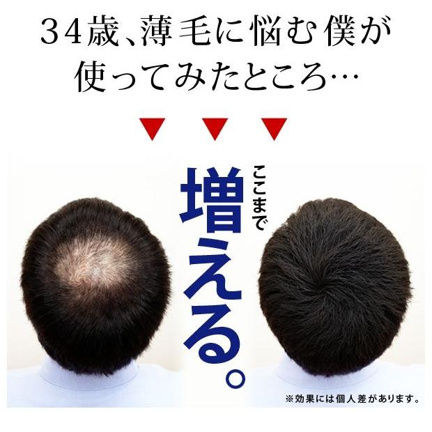 NEW ヘアフォロー ブラウン 薄毛 スプレー ボリュームアップ(代引き不可)｜rcmdse｜03