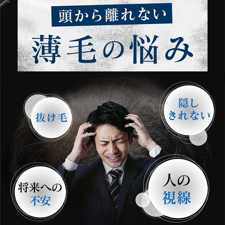 300円OFFクーポン発行中! 薬用スカルプローション VO-VO- 育毛 300円OFFクーポン発行中! 薬用スカルプローション VO-VO- 育毛