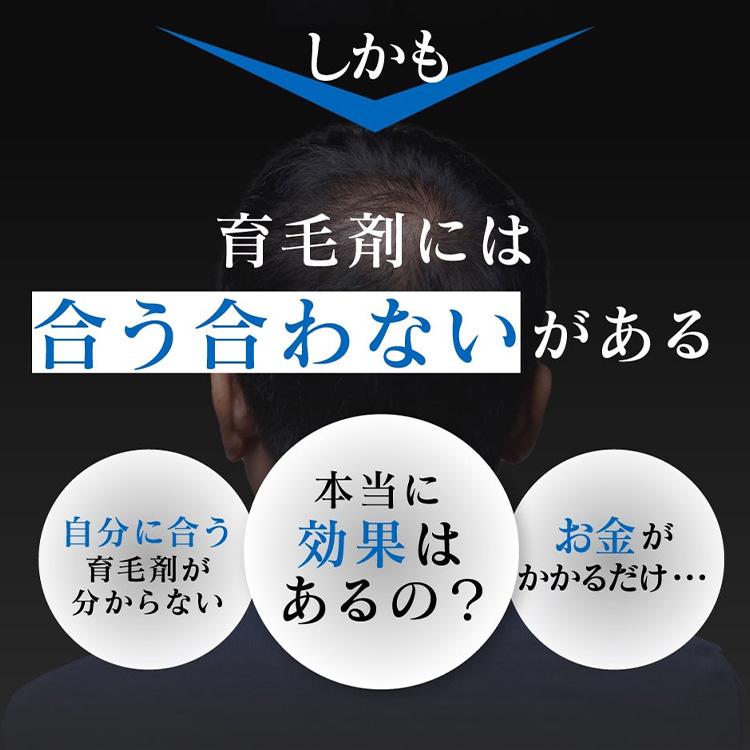 300円OFFクーポン発行中! 薬用スカルプローション VO-VO- 育毛 300円OFFクーポン発行中! 薬用スカルプローション VO-VO- 育毛
