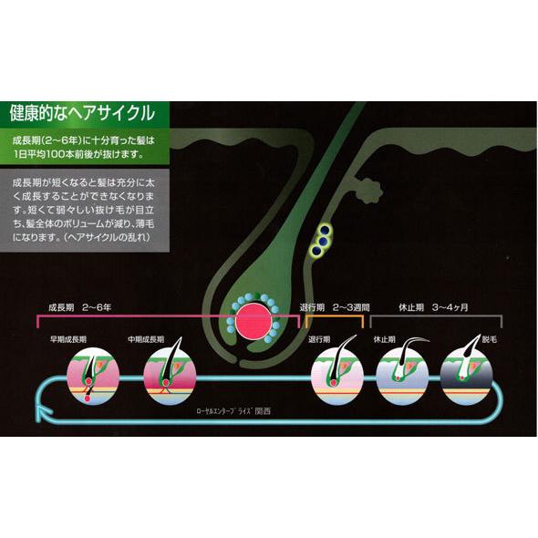 アシーズ 女性用 頭皮ローション ヒト毛根細胞順化培養液配合 76ml