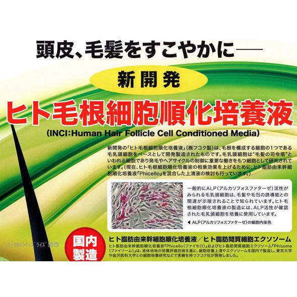 アシーズ 女性用 頭皮ローション ヒト毛根細胞順化培養液配合 76ml