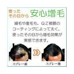 細い髪を太くする増毛スプレー ｑｚジェントリー 50ml 増毛ふりかけ パウダー かつら以外の薄毛隠し Gent 50bm リアンドゥ 通販 Yahoo ショッピング